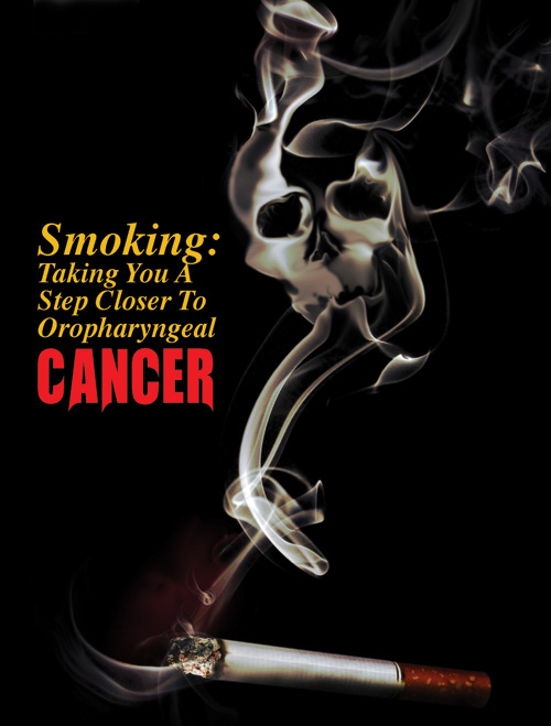 Smoking: Taking You A Step Closer To Oropharyngeal Cancer