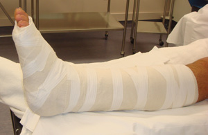 Care of Limb in Plaster