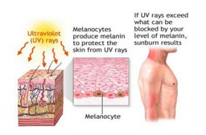 Sunburn, UV Overexposure & Skin Cancer: Prevention or Cure?