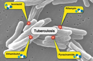 How Is Tuberculosis Treated?