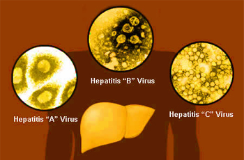 hepatitis_viruse