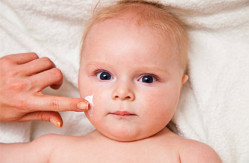 Infant Eczema 