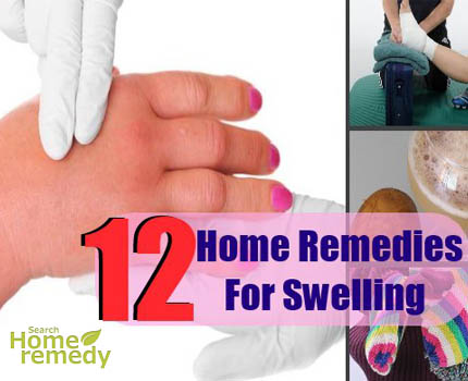Swelling home remedy